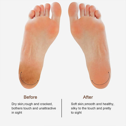 Electric Foot File Rechargeable Callus Hard Skin Remover Feet Pedicure 2 Speeds
